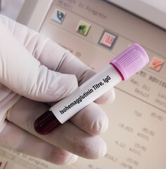 Fototapeta premium Blood sample for Isohemagglutinin Titer IgG test, Blood grouping, anti-A titer, anti-B titer, antibody screen.