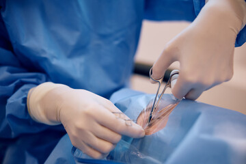 Close up of surgeon performing an eye surgery at clinic.
