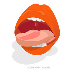 3D Isometric Flat  Illustration of Sore Or White Tongue. Item 3