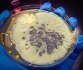 Malt Extract Agar in Petri dish using for growth media to isolate and cultivate yeasts, molds and fungal testing from neil scraping samples. Neil scraping for fungus culture.