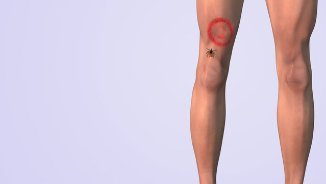 Lyme thigh red cells animation
