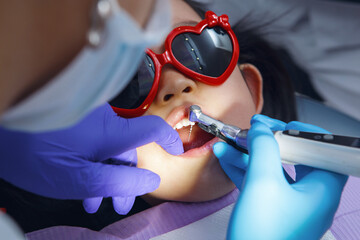 Child Undergoes Dental Filling Procedure for Caries in Modern Dentist Office