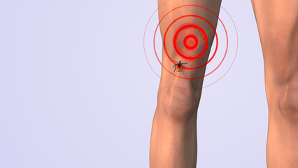 Lyme thigh red cells animation
 - obrazy, fototapety, plakaty