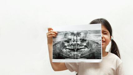 Caucasian Girl with a panoramic shot of teeth and jaw on a white background, close-up, diagnosis