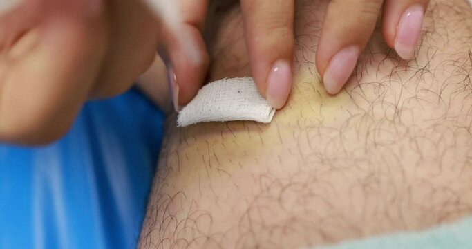 The hand of a nurse treats a wound on the patient's leg in a clinic room with a Selective focus, Nurses are treating a bleeding wound on the leg caused by an accident