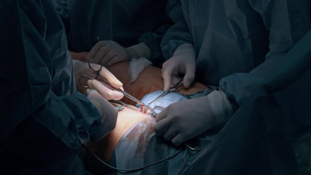 An experienced surgeon performs an operation to remove varicose veins on a woman's legs in clinic.