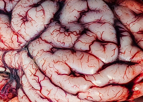 A close-up of the convolutions of a real brain