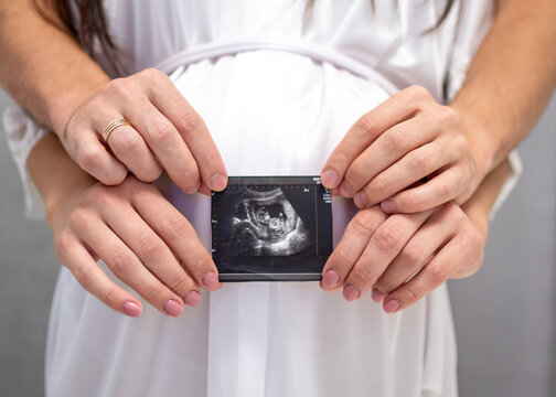 Expectant parents hold a sonogram image of an unborn child