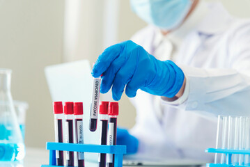 Close up Scientist man hands holding sample blood test tube science laboratory. Doctor clinic...