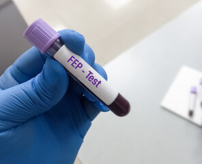 Blood sample tube for FEP or Free erythrocyte protoporphyrin test, diagnosis for iron deficiency...