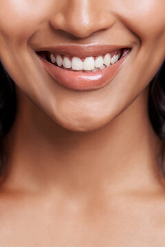 Woman, smile and mouth with teeth whitening for dental, health and oral hygiene with veneers. Skin, face and happy model for orthodontics, fresh breathe and glow with wellness, clean and beauty