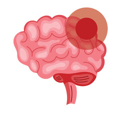 parkinson brain condition