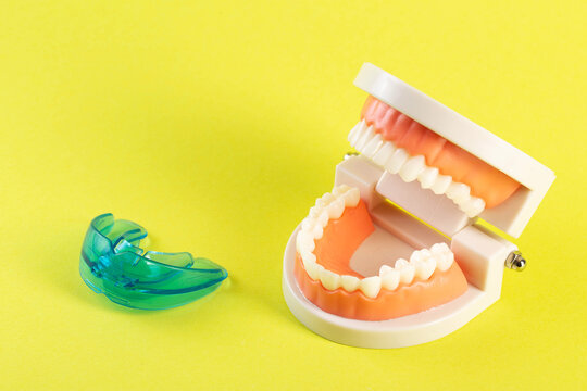 Therapeutic mouthguard on the background of a dental jaw mockup on a yellow background. Treatment of teeth grinding, bruxism in children and adults. Protecting tooth enamel 