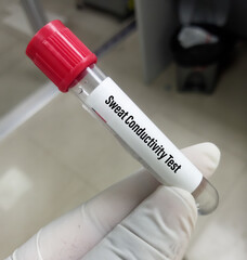 Scientist hold test tube with sample for sweat conductivity test. diagnosis of cystic fibrosis.