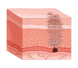 皮膚の断面（シミ発生のメカニズム）