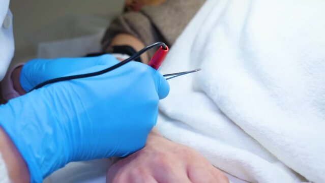 a master performs an electrodepilation procedure on a girl's arm 