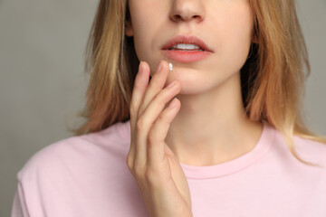 Woman with herpes applying cream onto lip against light grey background, closeup