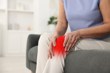 Arthritis symptoms. Woman suffering from pain in her knee on sofa indoors, closeup. Space for text