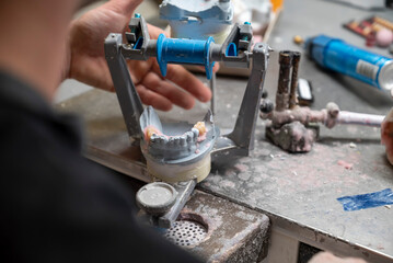 création sur un support e dent de remplacement en bridge dans un laboratoire dentaire © Esta Webster