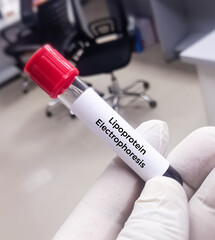 Blood sample for lipoprotein Electrophoresis test to determining the nature of a dyslipoproteinemia...