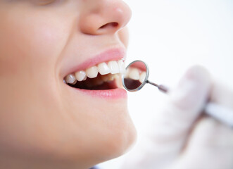 visit to the dentist - 769611542