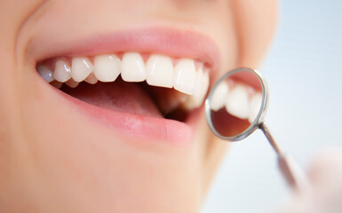 visit to the dentist - 769611577