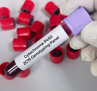 Blood sample for Cytochrome P450 2C19 genotyping test. CYP2C19 genotyping.