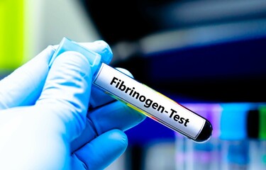 Blood sampling tube for fibrinogen test analysis.