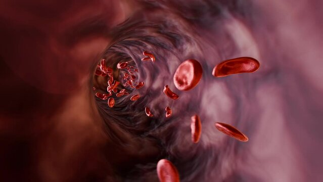 Blood Vessel: Sickle Cell