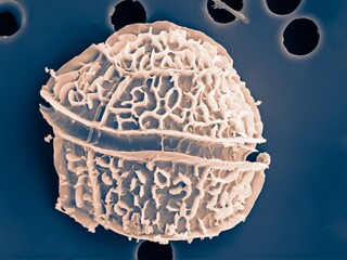 dinoflagellate photographed with the electron microscope