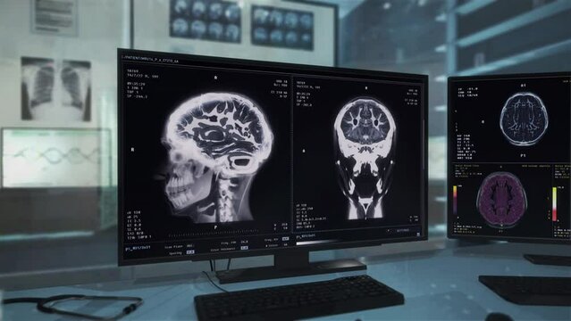 Anatomical analysis of the patients head at the healthcare clinic. Anatomy analysis scanning through the patients skull. Medical Anatomy analysis imaging of the patients brain matter. Radiology