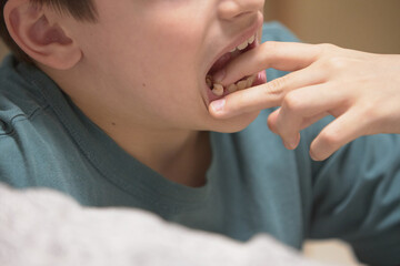 A boy's tooth falls out of his mouth in close-up