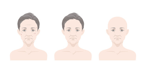 中年女性の正面顔セット（髪の毛なし・シミ、シワ・老化）