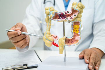 Intestine, appendix and digestive system, doctor holding anatomy model for study diagnosis and...