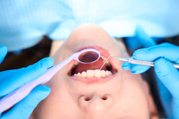 Dentist uses special tools to clean teeth and tartar