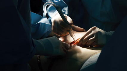 A team of surgeons operates on a young client in a modern operating room. Plastic surgery,...