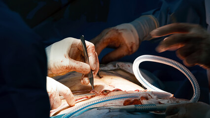A team of surgeons operates on a young client in a modern operating room. Plastic surgery,...