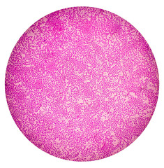 Salmonellosis. Microscopic view of gram stained slide from blood agar salmonella colonies, show...