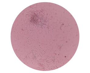 Microscopic image from fungus colonies at Sabouraud Dextrose Agar (SDA) media. Malt Extract Agar media in Petri dish use for cultivate yeast, black molds and fungi clinical test.