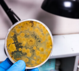 Malt Extract Agar in Petri dish using for growth media to isolate and cultivate yeasts, molds and fungal testing from Neil scraping samples. Neil scraping for fungus culture.