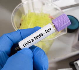 Blood sample for AP100 test, total hemolytic complement. to measurement of complement haemolytic activity.