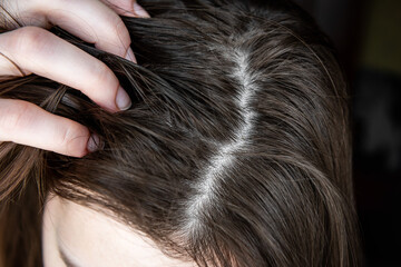 Young woman holding dirty greasy hair.