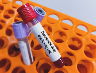 Blood Sample for Therapeutic Drug Monitoring Test.