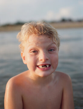 Grinning Boy Shows Off Missing Teeth
