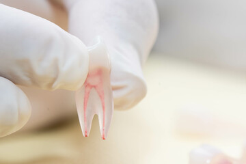 tooth endodontics