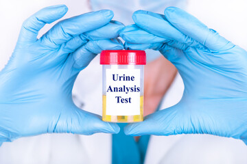 Laboratory sample of urine for drugs or substance test. Drug test is technical analysis of specimen to determine illegal drug abuse as cannabis, cocaine, methamphetamine, heroin and alcohol level. - obrazy, fototapety, plakaty