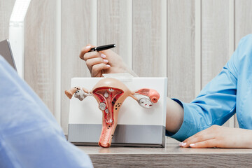Gynecologist doctor shows pen on plastic model of uterus and ovaries to woman in clinic. Anatomical...