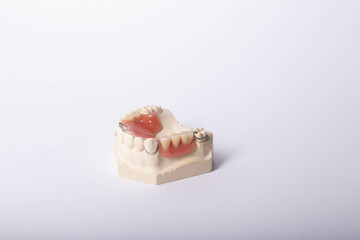 Dental cast during processing denture.