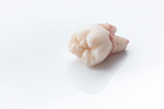 a freshly extracted wisdom tooth with some blood on a white background, visit to the dentist, oral care, space for copy, selective focus