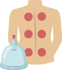 Hijama cupping therapy illustration 